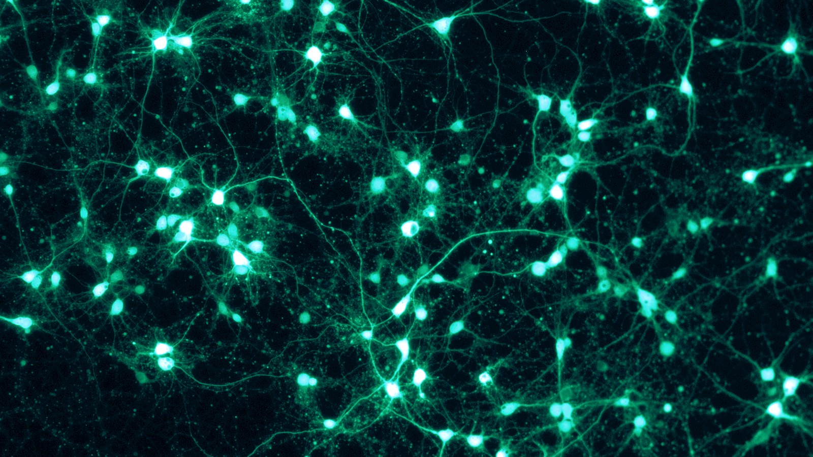 Réseau de neurones illuminés en vert observés au microscope